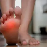 Pie con zona roja de dolor, indicando posible neuroma de Morton.