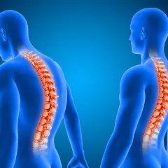 Dos figuras humanas azules muestran la columna vertebral en naranja.