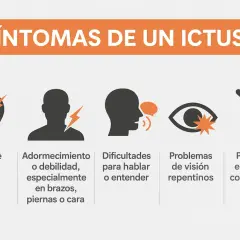 Síntomas de un ictus isquémico: dolor de cabeza, adormecimiento, dificultad para hablar, problemas de visión y pérdida de equilibrio.