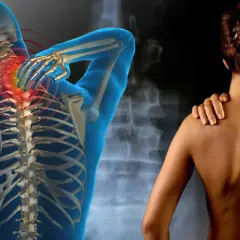 Anatomía humana con columna vertebral resaltada en rojo, sugiriendo dolor. Una mujer se toca el hombro. Podría ser una representación de la distrofia muscular.