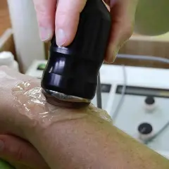 Tratamiento con ultrasonido para aliviar la tendinitis mano. Un profesional aplica gel y un dispositivo sobre la muñeca.