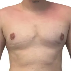 Torso con tatuajes y cicatrices visibles en los musculos del pecho. La palabra "héroe" tatuada en el cuello.