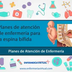 Ilustración de un bebé con espina bífida y su columna vertebral. El texto indica "Planes de atención de enfermería para la espina bífida".