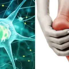 Ilustración de neuronas y un pie con dolor, representando la neuropatía periférica.