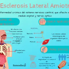 Infografía sobre la ELA, mostrando sus primeros síntomas como pérdida de control del movimiento, calambres y dificultad para respirar.
