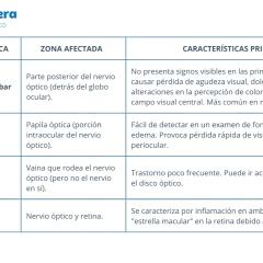 Tabla comparativa de tipos de neuritis óptica: retrobulbar, anterior (papilitis), perineuritis y neurorretinitis, detallando zona afectada y características.