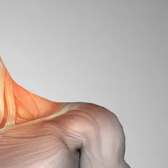 Anatomía del cuello y hombro, resaltando los escalenos musculos con un tono rojizo, indicando posible tensión o dolor.