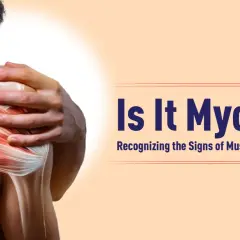 Ilustración de un hombro con músculos inflamados y la pregunta "¿Es Miositis? Reconociendo los signos de inflamación muscular.