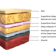 Corte transversal de la piel, mostrando varios tipos de fascia, tejido adiposo y músculo.