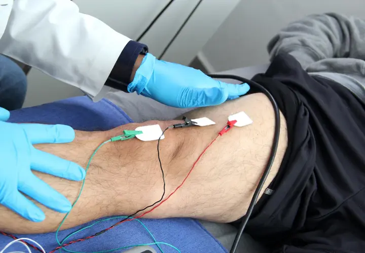 Un profesional médico con guantes azules realiza una electromiografía que es un estudio de la actividad eléctrica de los músculos.