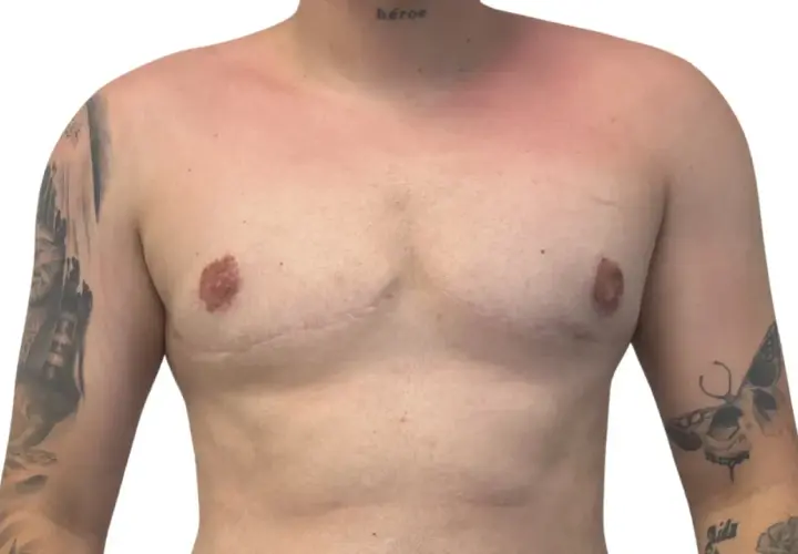 Torso con tatuajes y cicatrices visibles en los musculos del pecho. La palabra "héroe" tatuada en el cuello.