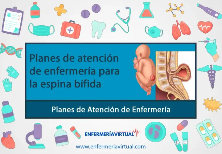 Ilustración de un bebé con espina bífida y su columna vertebral. El texto indica "Planes de atención de enfermería para la espina bífida".