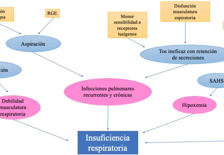 Diagrama de flujo que ilustra cómo la parálisis cerebral puede llevar a insuficiencia respiratoria a través de aspiración, infecciones y debilidad muscular.
