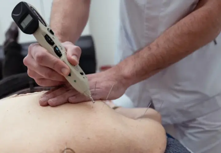 Terapeuta usa un neuroestimulador medular para aplicar acupuntura en la espalda de un paciente, buscando alivio del dolor.