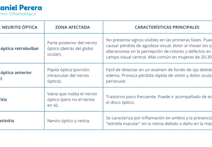 Tabla comparativa de tipos de neuritis óptica: retrobulbar, anterior (papilitis), perineuritis y neurorretinitis, detallando zona afectada y características.