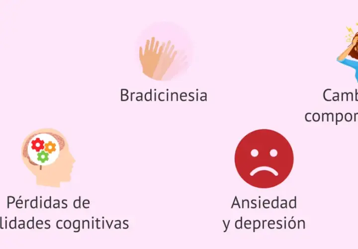 Síntomas de la enfermedad de Huntington: corea, bradicinesia, cambios de comportamiento, pérdidas cognitivas, ansiedad y depresión.
