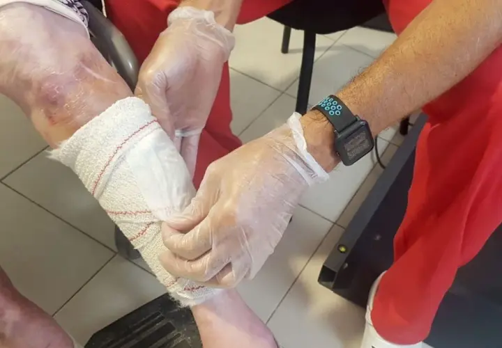 Manos enguantadas vendan pierna con úlceras por presión.