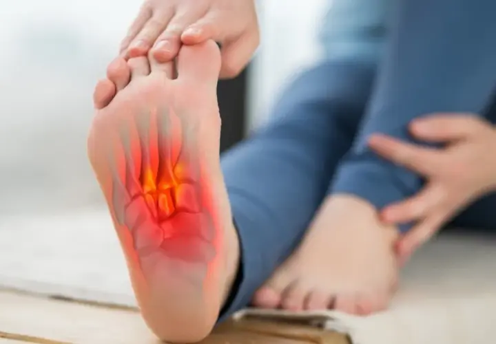 Pie con dolor e inflamación en la planta, indicando fascitis plantar.