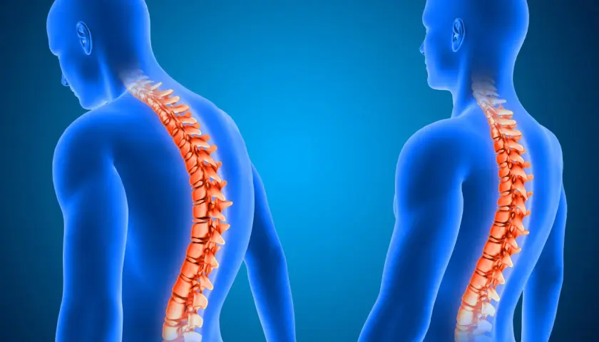 Dos figuras humanas azules muestran la columna vertebral en naranja.