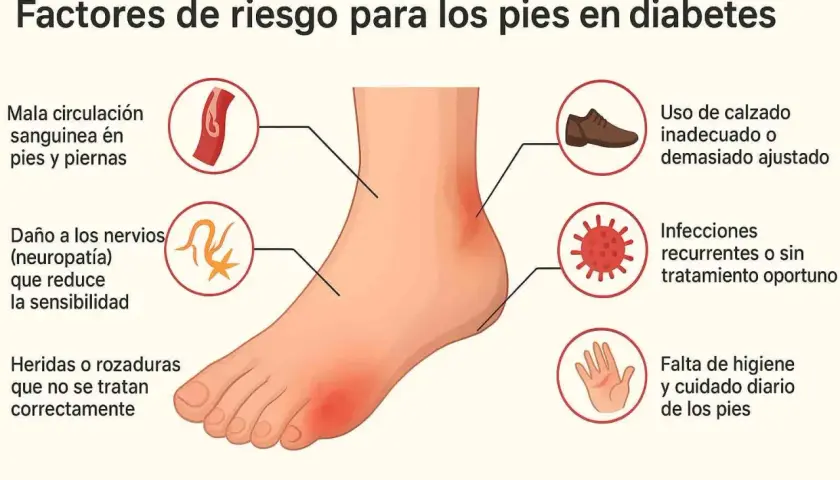 Factores de riesgo para pies diabéticos: mala circulación, neuropatía, heridas, calzado inadecuado, infecciones y falta de higiene.