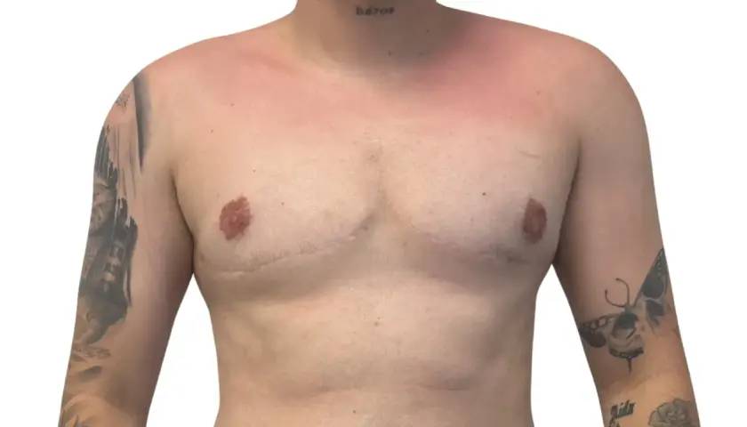 Torso con tatuajes y cicatrices visibles en los musculos del pecho. La palabra "héroe" tatuada en el cuello.
