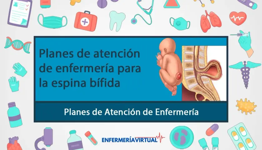 Ilustración de un bebé con espina bífida y su columna vertebral. El texto indica "Planes de atención de enfermería para la espina bífida".