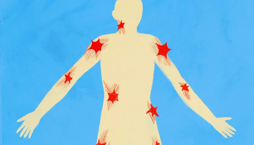 Silueta humana con puntos rojos que representan qué son los puntos gatillo, distribuidos en cuello, hombros, brazos y torso.