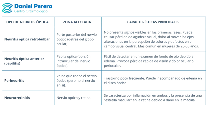 Tabla comparativa de tipos de neuritis óptica: retrobulbar, anterior (papilitis), perineuritis y neurorretinitis, detallando zona afectada y características.