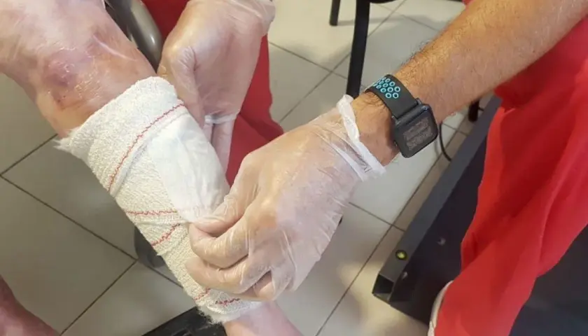 Manos enguantadas vendan pierna con úlceras por presión.