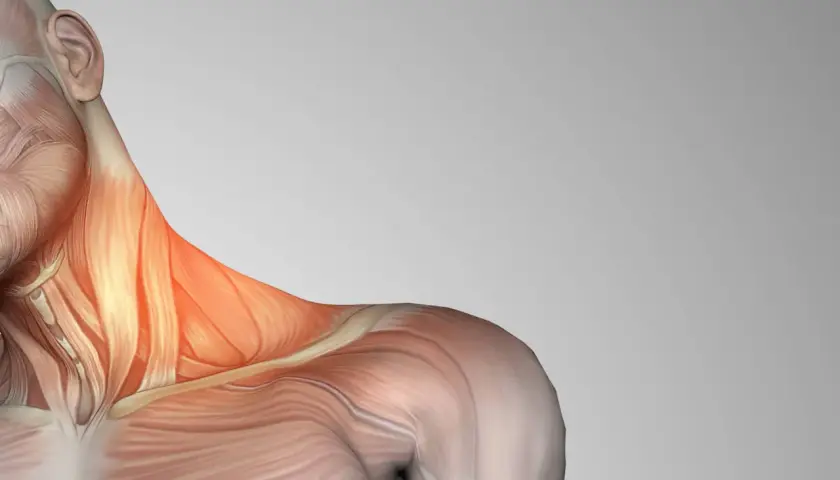 Anatomía del cuello y hombro, resaltando los escalenos musculos con un tono rojizo, indicando posible tensión o dolor.