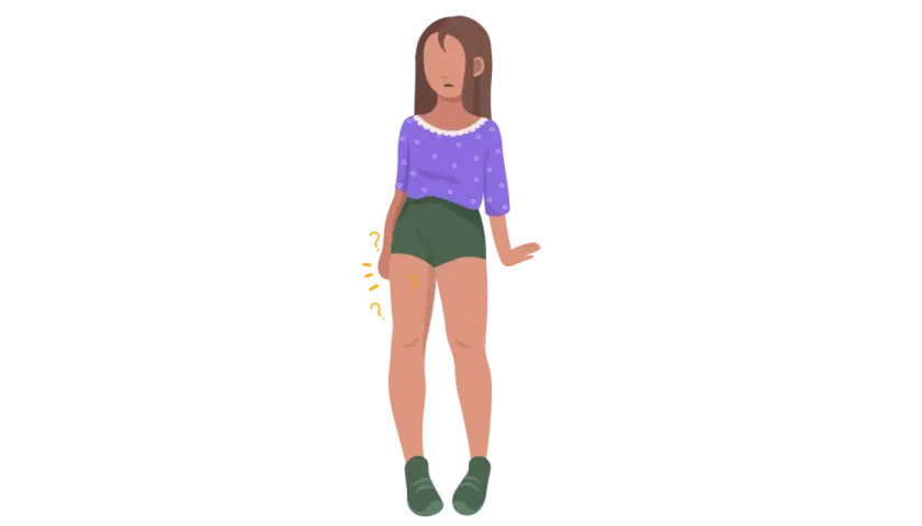 Mujer con shorts verdes y blusa morada, con signos de interrogación amarillos en el muslo derecho, sugiriendo meralgia parestésica.