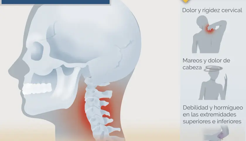 Ilustración de la columna cervical con zonas de dolor, junto a iconos de síntomas.