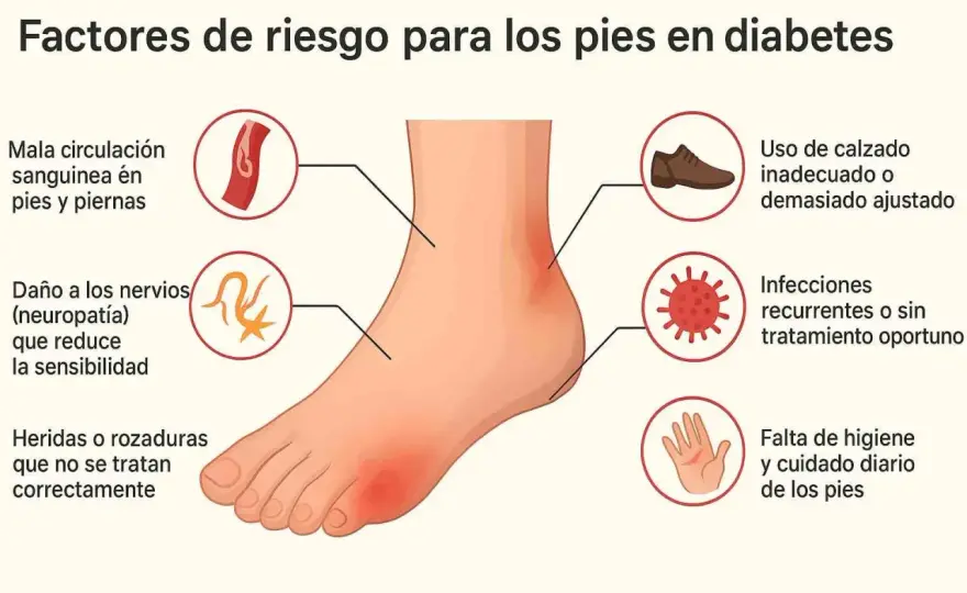 Neuropatía diabética - ¿Es solo hormigueo? Guía completa