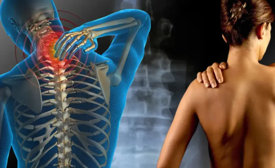 Distrofia Muscular - Síntomas, Diagnóstico y Fisioterapia Clave