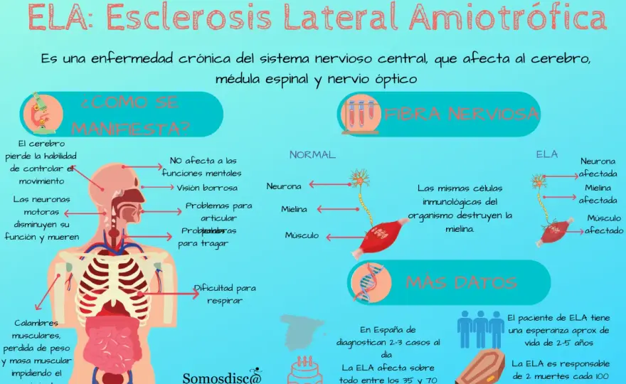 ELA - Síntomas iniciales: ¿Qué buscar y cuándo actuar?