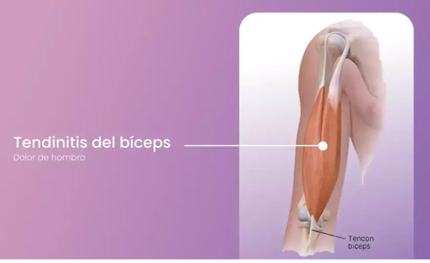Bíceps braquial - Anatomía, función y por qué duele