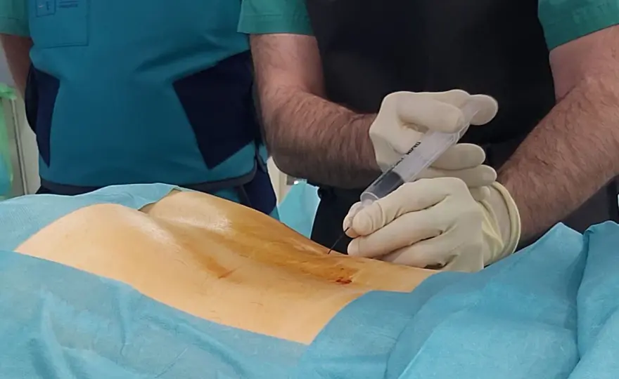 Ozonoterapia hernia discal - ¿Solución o paso intermedio?