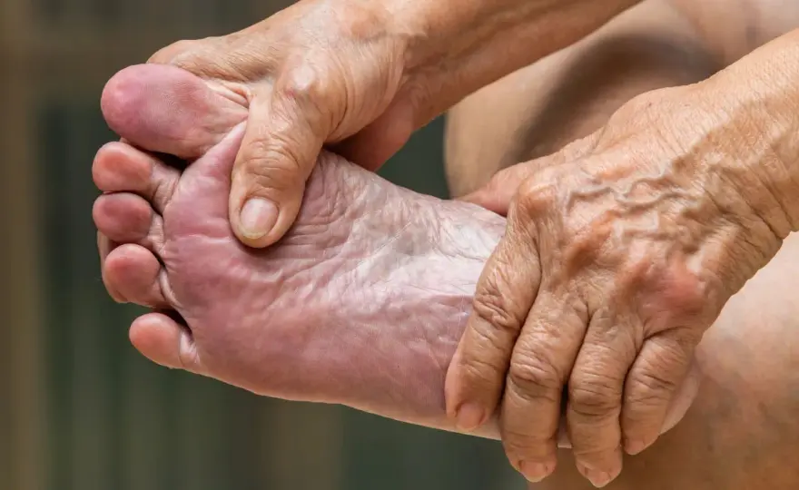 Dolor de pies - Qué lo causa y cuándo buscar ayuda
