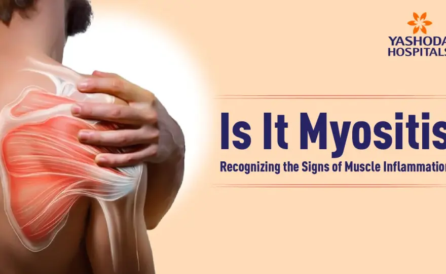 Miositis - ¿Es más que un dolor muscular? Guía completa