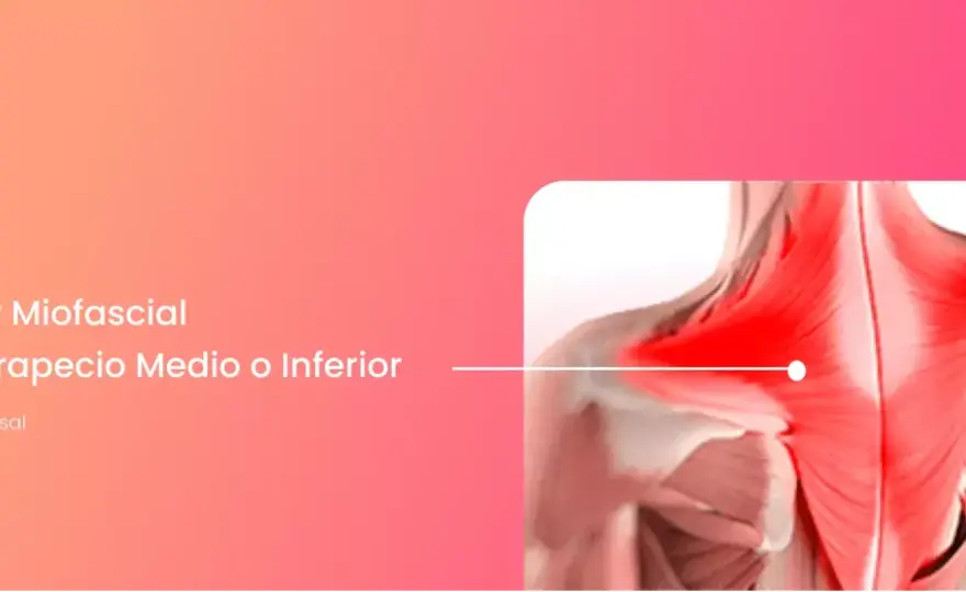 Trapecio inflamado - Alivio rápido y soluciones duraderas