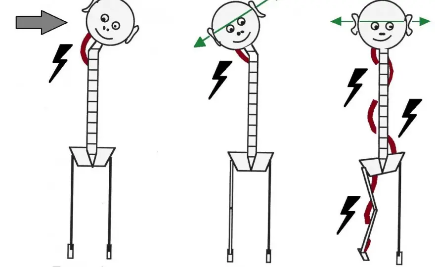 Cadenas musculares - Entiende tu dolor y muévete mejor