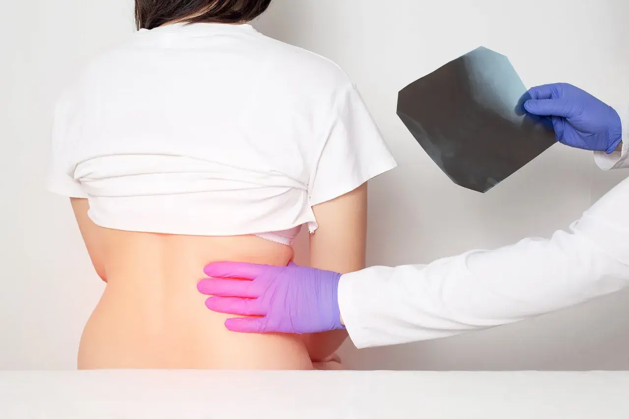 Médico examina radiografía mientras palpa la espalda baja de un paciente, buscando la causa del dolor costillas espalda.