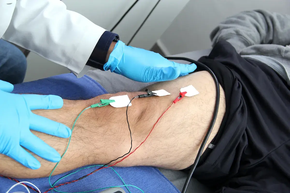 Un profesional médico con guantes azules realiza una electromiografía que es un estudio de la actividad eléctrica de los músculos.