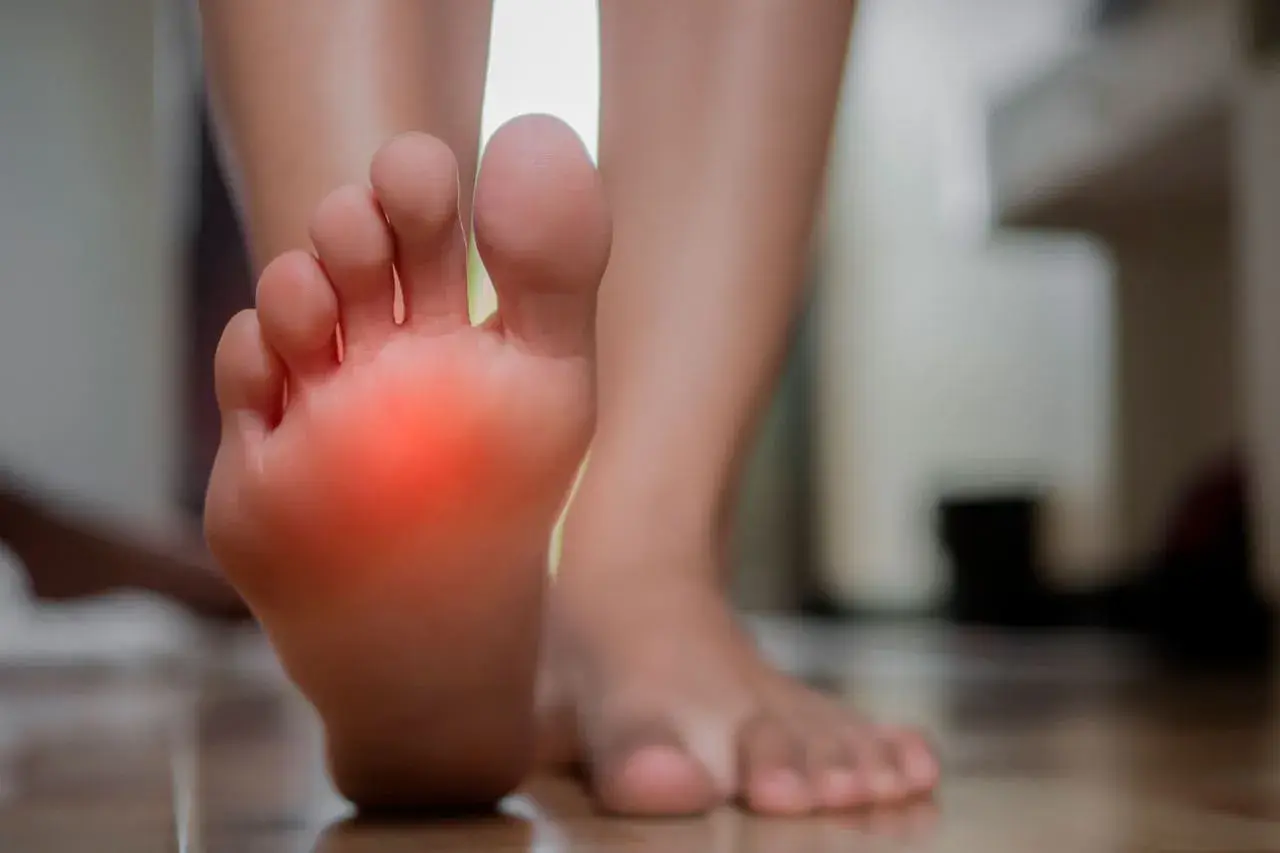 Pie con zona roja de dolor, indicando posible neuroma de Morton.