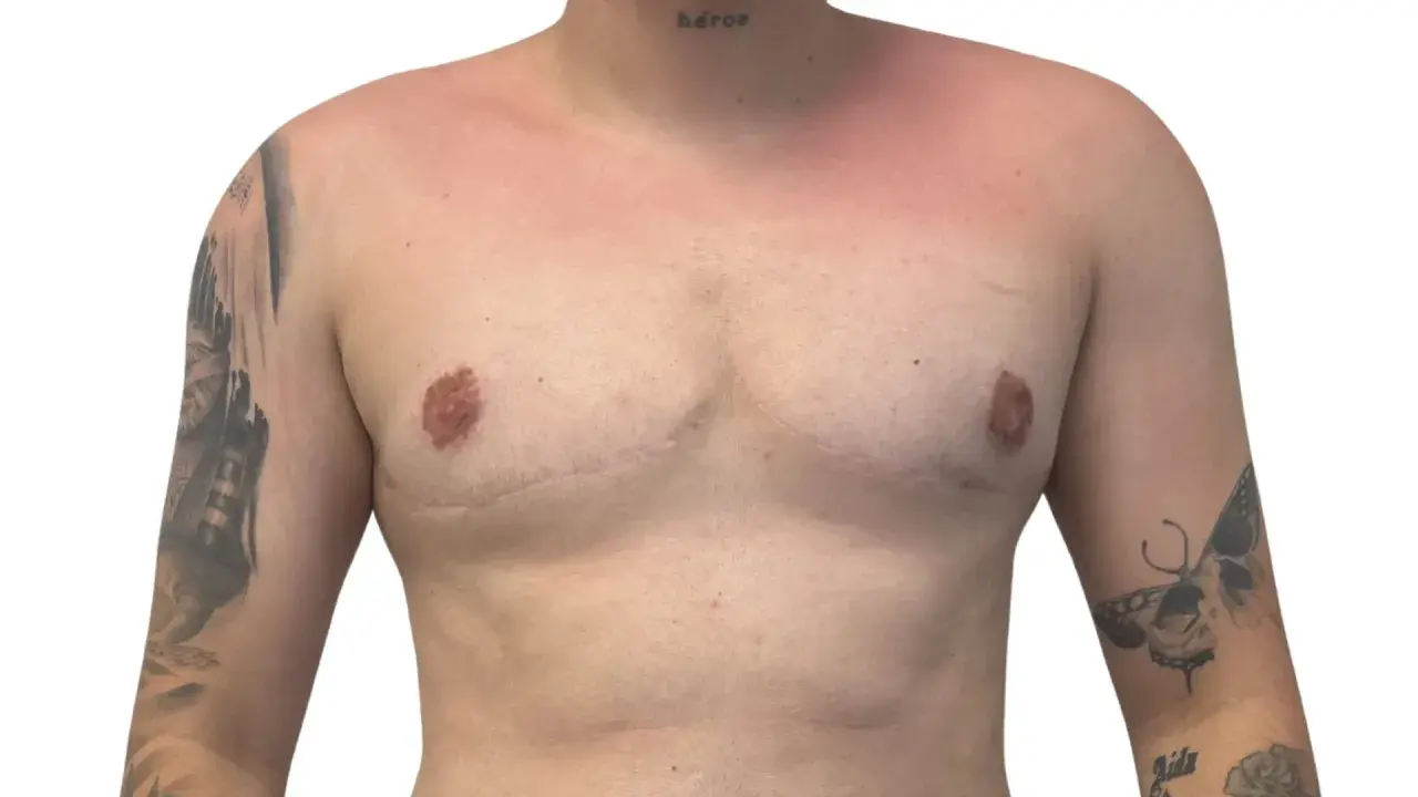 Torso con tatuajes y cicatrices visibles en los musculos del pecho. La palabra "héroe" tatuada en el cuello.