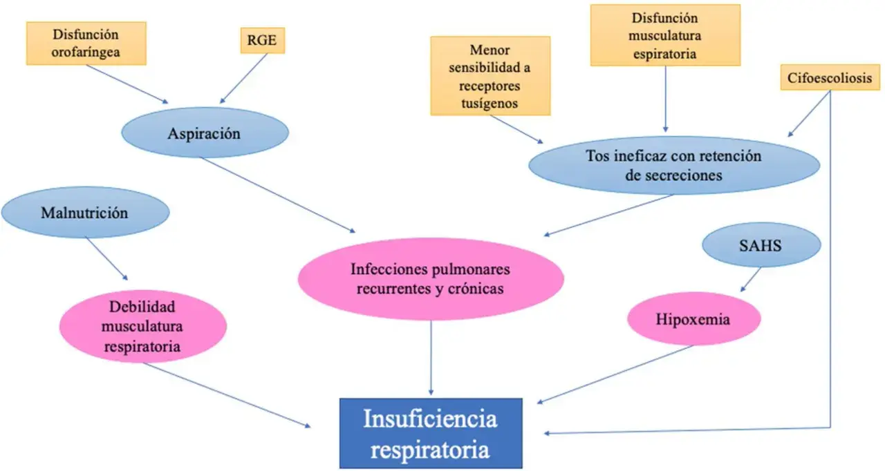 Diagrama de flujo que ilustra cómo la parálisis cerebral puede llevar a insuficiencia respiratoria a través de aspiración, infecciones y debilidad muscular.