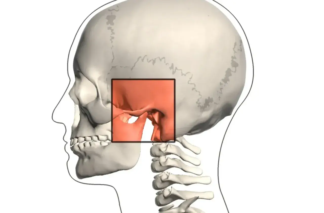 Vista lateral de un cráneo humano, con un recuadro resaltando la articulación temporomandibular.