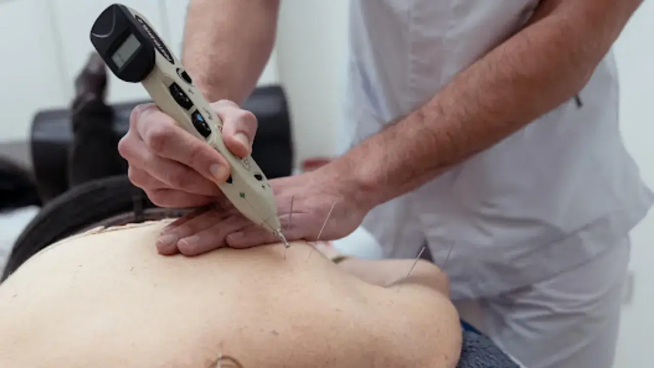 Terapeuta usa un neuroestimulador medular para aplicar acupuntura en la espalda de un paciente, buscando alivio del dolor.