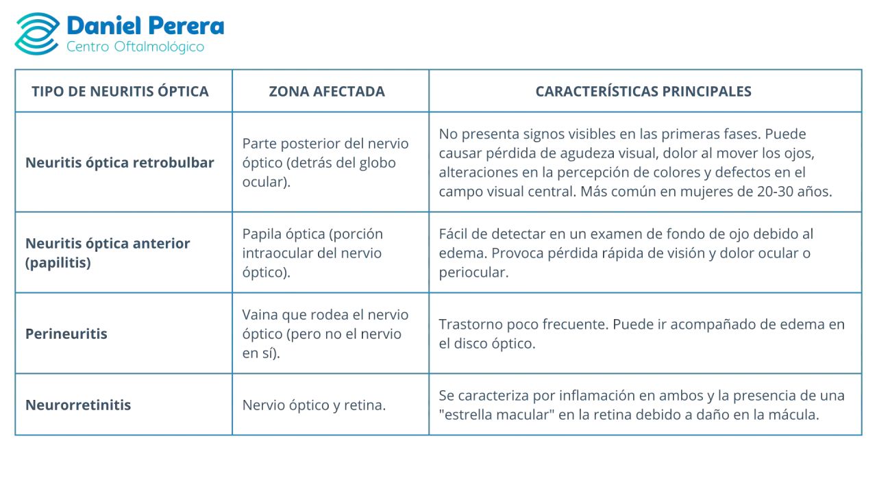 Tabla comparativa de tipos de neuritis óptica: retrobulbar, anterior (papilitis), perineuritis y neurorretinitis, detallando zona afectada y características.