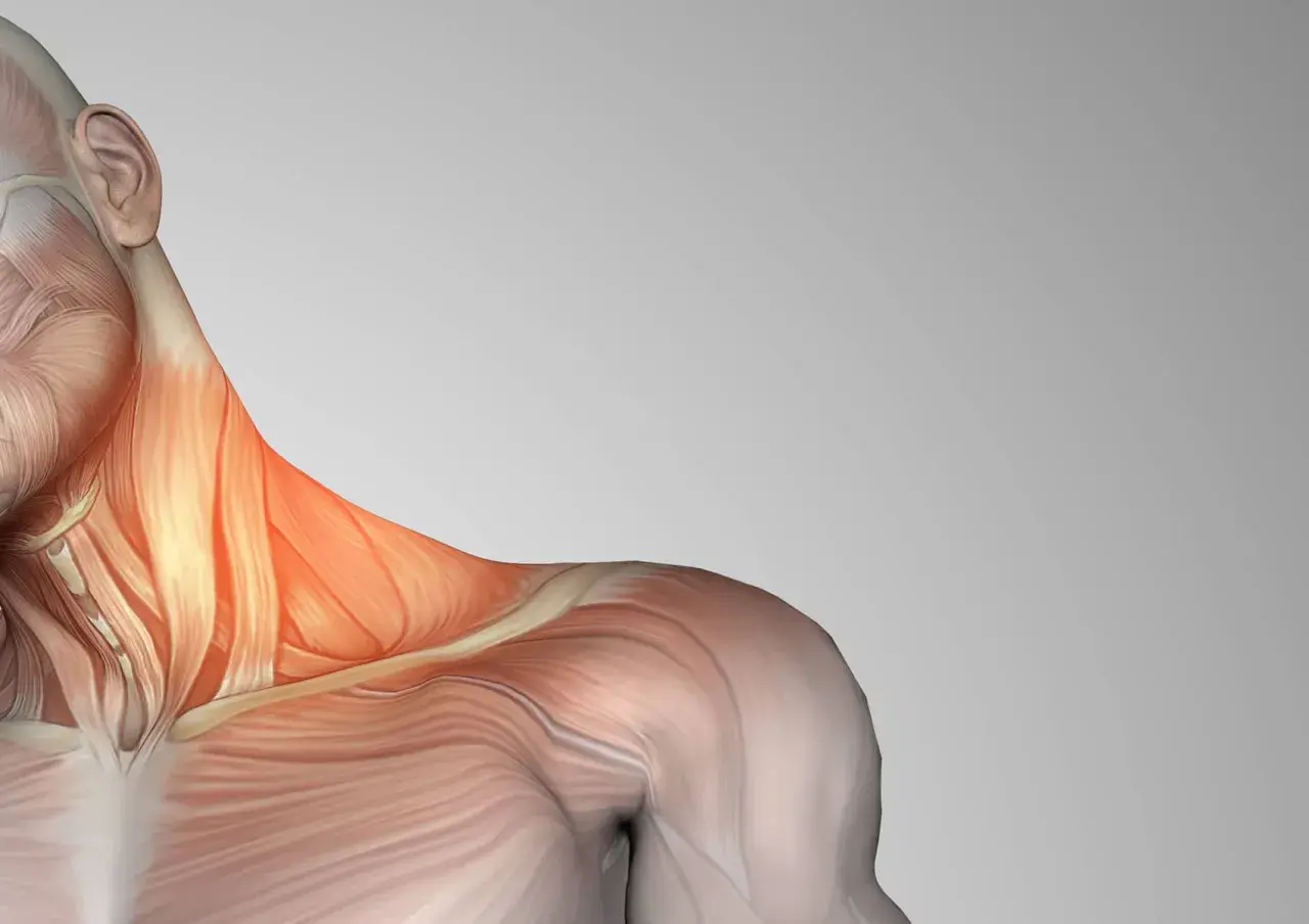 Anatomía del cuello y hombro, resaltando los escalenos musculos con un tono rojizo, indicando posible tensión o dolor.